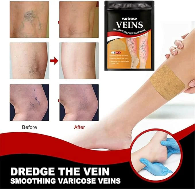 VitaVena - Alivio natural para tus piernas cansadas